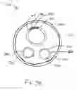 Fig. 06 - Multiple electrode implantable lead