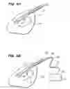 Fig. 04 - Systems and methods for creating a lesion using transjugular approach