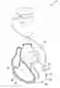 Fig. 01 - Epicardial lead fixation system