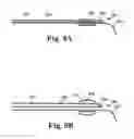 Fig. 09 - Anchor for electrode delivery system