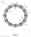 Fig. 03 - Cuff and sleeve system for gastrointestinal bypass