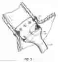 Fig. 04 - Cuff and sleeve system for gastrointestinal bypass
