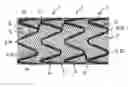 Fig. 01 - Stent assembly