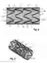 Fig. 04 - Stent assembly