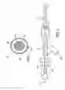 Fig. 06 - Formed in place corpectomy device