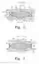 Fig. 03 - Intervertebral disc prosthesis and associated methods