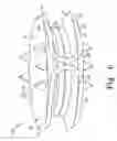 Fig. 05 - Intervertebral disc prosthesis and associated methods