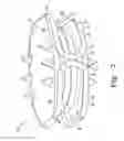 Fig. 06 - Intervertebral disc prosthesis and associated methods