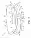 Fig. 07 - Intervertebral disc prosthesis and associated methods