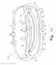 Fig. 10 - Intervertebral disc prosthesis and associated methods