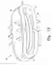 Fig. 12 - Intervertebral disc prosthesis and associated methods