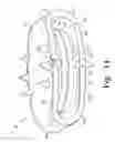 Fig. 13 - Intervertebral disc prosthesis and associated methods