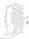 Fig. 14 - Intervertebral disc prosthesis and associated methods