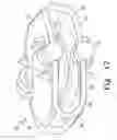 Fig. 16 - Intervertebral disc prosthesis and associated methods
