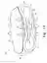 Fig. 18 - Intervertebral disc prosthesis and associated methods