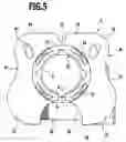 Fig. 06 - Vertebral body replacement implant