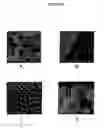 Fig. 06 - Implants with textured surface and methods for producing the same