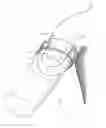 Fig. 01 - Method of attaching a strapless prosthetic arm