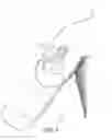 Fig. 06 - Method of attaching a strapless prosthetic arm