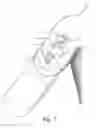 Fig. 08 - Method of attaching a strapless prosthetic arm