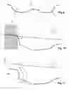 Fig. 04 - Determination of a model of a geometry of a metal sheet forming stage