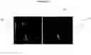 Fig. 03 - Real-time structure suppression in ultrasonically scanned volumes