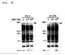 Fig. 11 - Therapeutic and diagnostic applications of prostatic acid phosphatase in prostate cancer