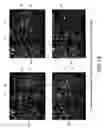 Fig. 16 - Isolated eIF-5A and polynucleotides encoding same