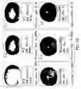 Fig. 79 - Isolated eIF-5A and polynucleotides encoding same