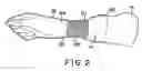 Fig. 03 - Surgical gown with elastomeric fibrous sleeves