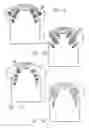 Fig. 05 - Torso garment