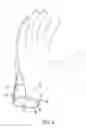 Fig. 07 - Wrist closure system for an athletic glove