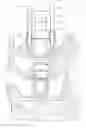 Fig. 01 - FUEL INJECTOR PULLING TOOL