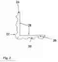 Fig. 03 - Decorative corner guard