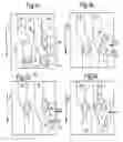 Fig. 03 - Shift drum having an insertion-groove flank movable axially with respect to a shift drum axis and shifting method