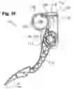 Fig. 06 - Accelerator pedal for a motor vehicle