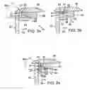 Fig. 03 - Kickdown mechanism for pedal assembly