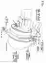 Fig. 06 - Hat embroidery accessory