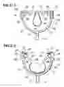 Fig. 03 - Thrust fork