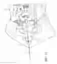 Fig. 19 - Pleated bag for interventional pullback systems
