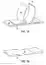 Fig. 02 - Non invasive external limb stabilizer