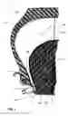Fig. 02 - Assemblies comprising an insert allowing flat running