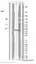 Fig. 01 - Isolation assembly for coiled tubing