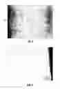 Fig. 08 - Asymmetric graded composites for improved drill bits