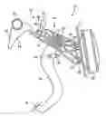 Fig. 01 - Vehicle-pedal backward-displacement preventing device