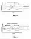 Fig. 05 - Fixing device and image forming apparatus