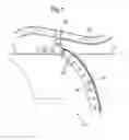 Fig. 02 - Clipping bracket