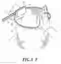 Fig. 09 - Flexible trash can frame for environmental protection