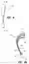 Fig. 04 - In the ear auxiliary microphone for behind the ear hearing prosthetic