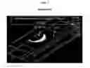 Fig. 03 - Liquid crystal display device including protection pad